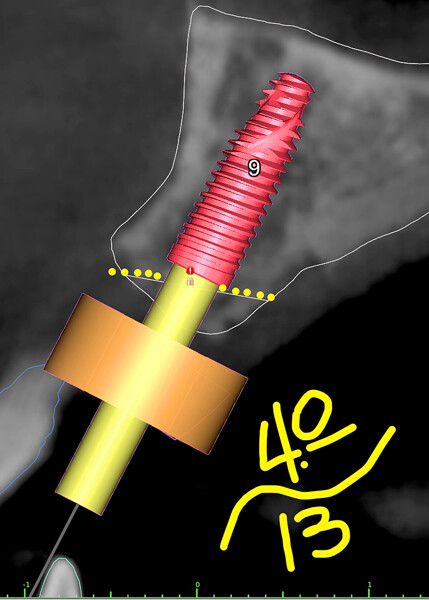 Fig. 5e