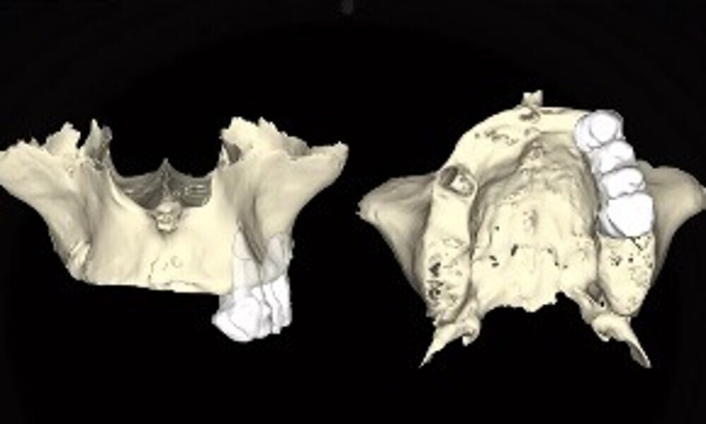 Fig. 13