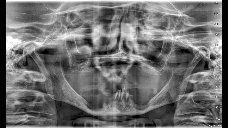 Fig. 5