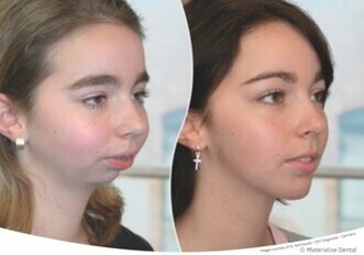SimPlant® O&O (Orthodontics & Orthognatics)