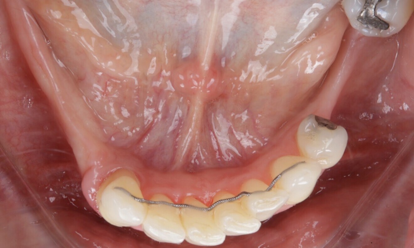 Fig. 7