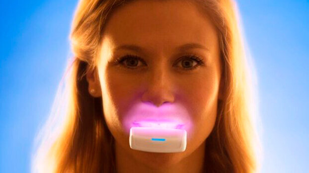 La PBM, terapia intra-orale di fotobiomodulazione potrebbe ridurre il tempo di trattamento ortodontico