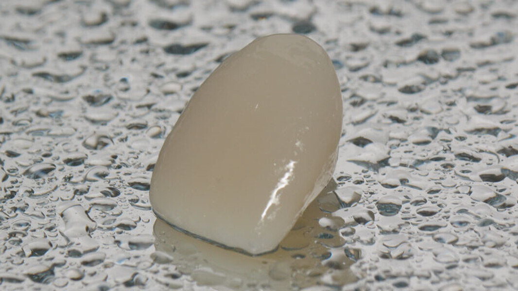 Figura 8. Corona provisional ExperTemp (Ultradent).