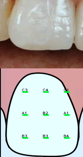 Denthue 7