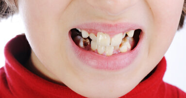 Oral health emphasised in Northern Ireland health funding report