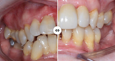 Align Technology announces winner of Invisalign Ortho Summit Case Shoot-Out