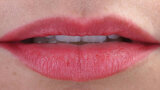 Fig. 17c. Labios en reposo, exposición de los bordes incisales.