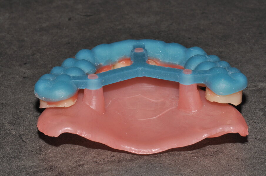 Fig. 18 - Le parti che compongono il dispositivo di rimontaggio assemblate tra loro perfettamente.