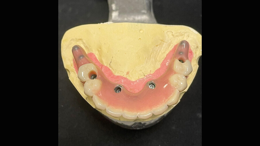 Fig. 14