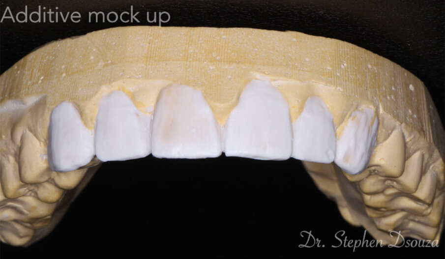 Fig. 6: Mock up.
