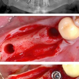 Zaniol_case
