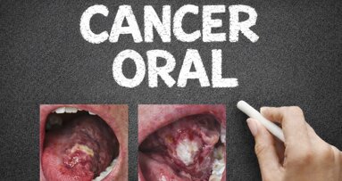 Cómo prevenir la mortalidad del cáncer oral