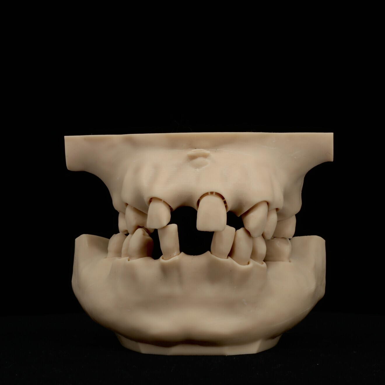 Fig. 11