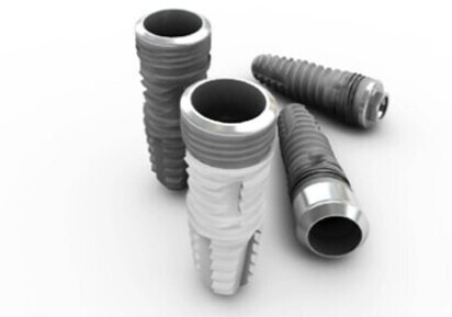 SM Implant System