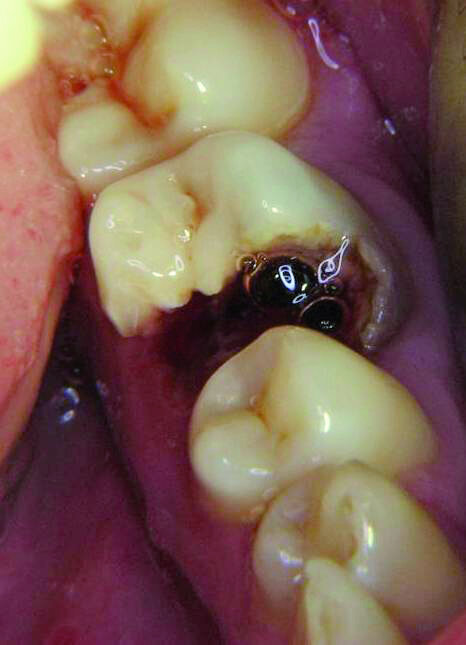 Figure 10a