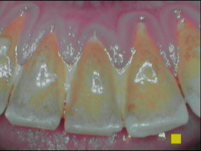 Fig. 3