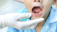 Study highlights barriers to dental care for UAE children with special needs