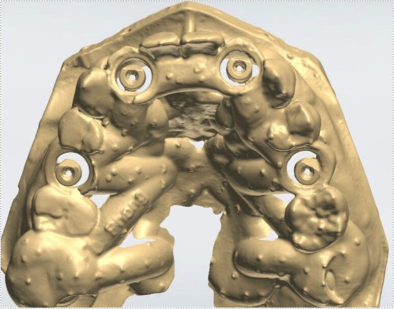 Fig. 25