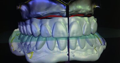 Value chains being transformed by new digital dental technologies