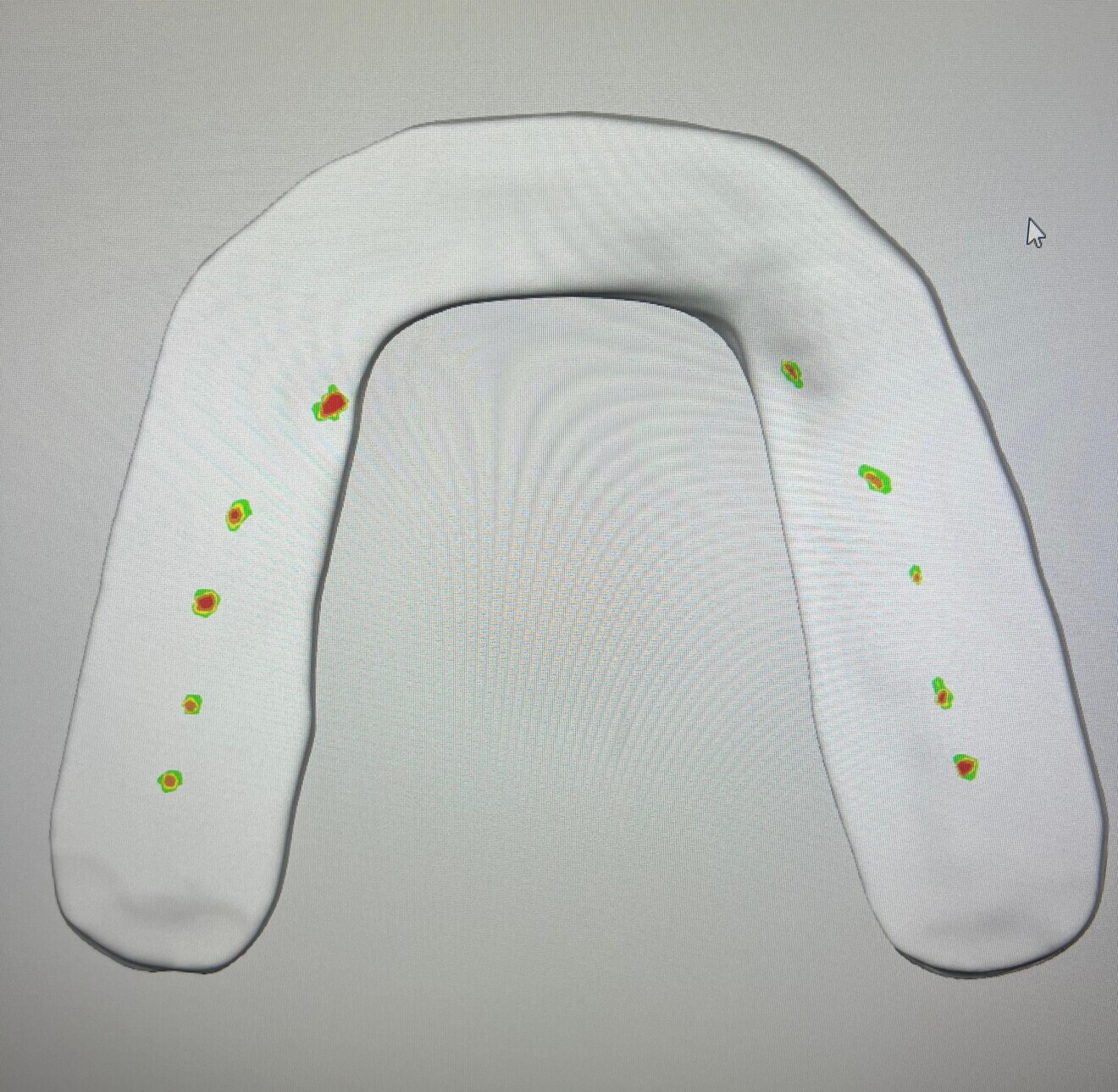 Fig. 16