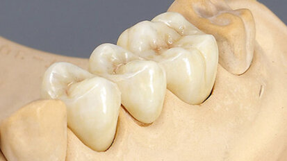 CAD/CAM, la tecnología que está revolucionando la industria dental (1)
