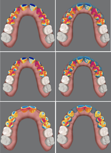 Fig. 21