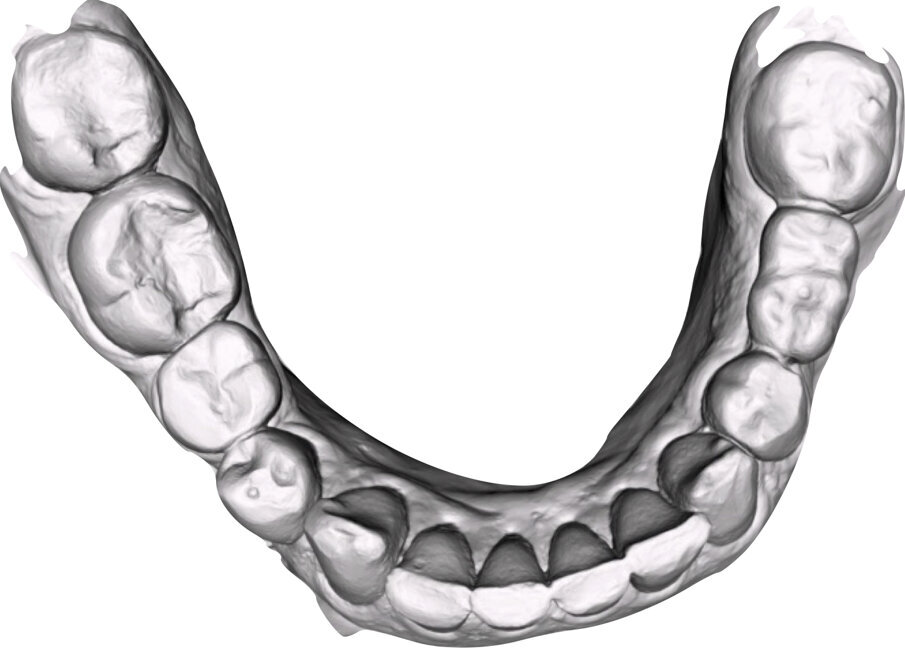 Fig. 14