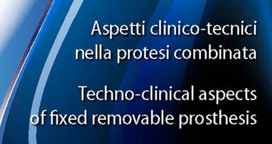 Aspetti clinico-tecnici nella protesi combinata