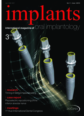 implants international