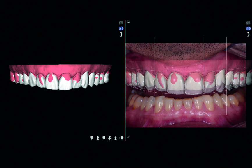 Fig. 9 : Planification DSD.