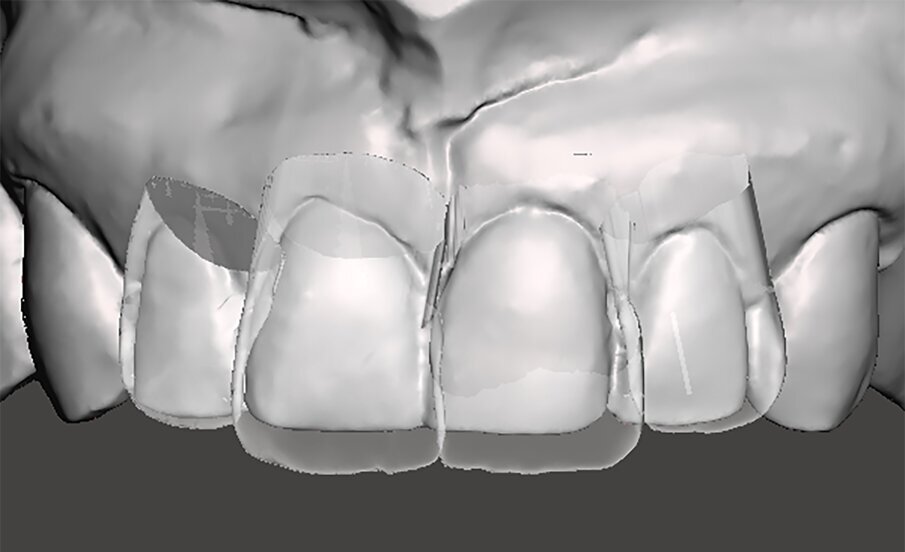 Fig. 10i