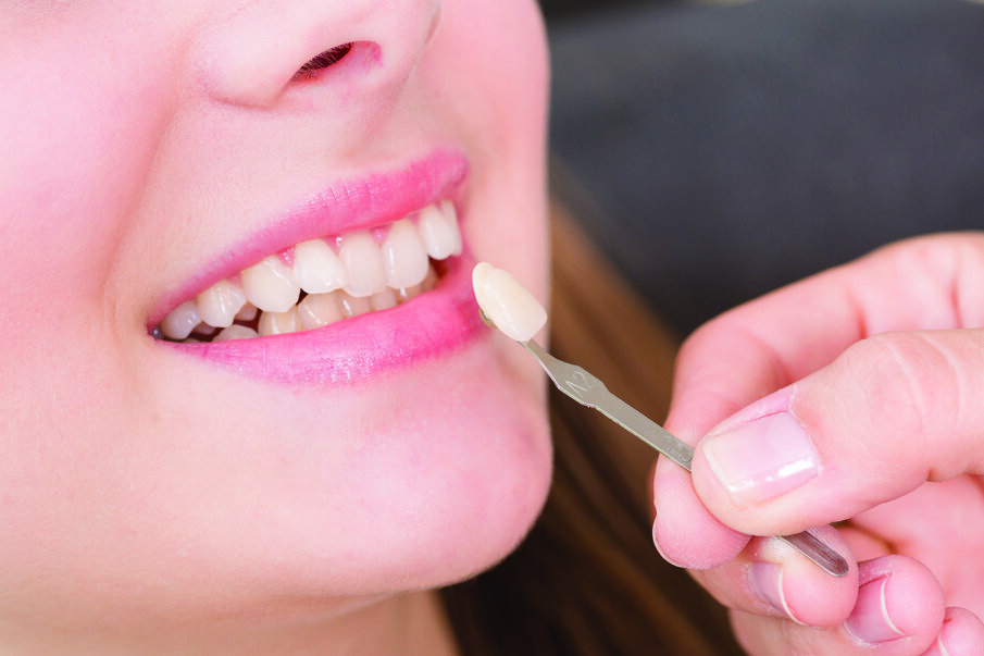 Veneers used to be a common means of treating misaligned teeth before there was increased public awareness of invisible appliances.