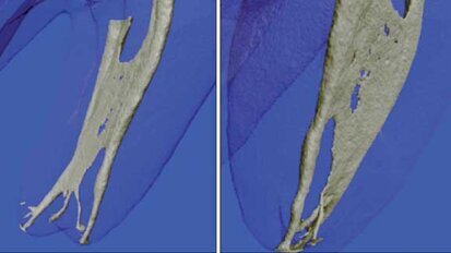 Endodontic irrigants and irrigant delivery systems