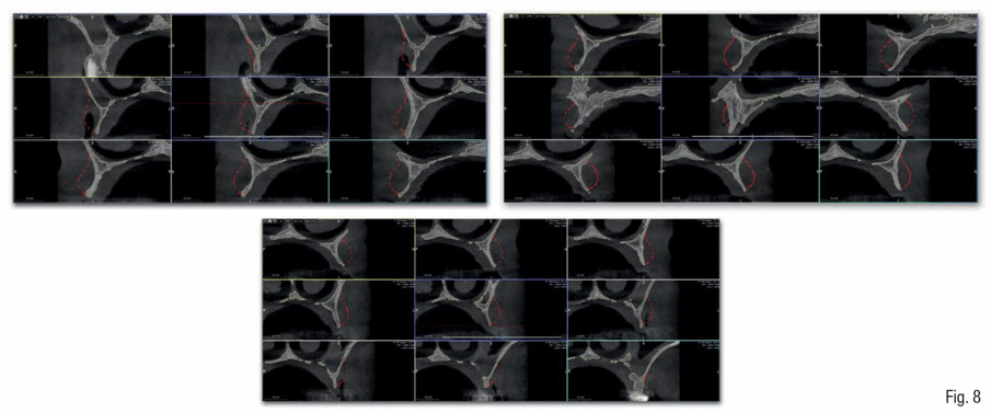 Fig. 8