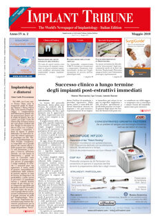 Implant Tribune Italy