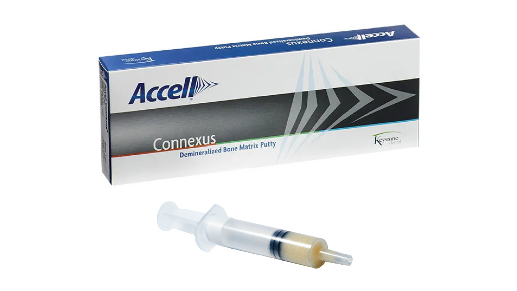 Accell