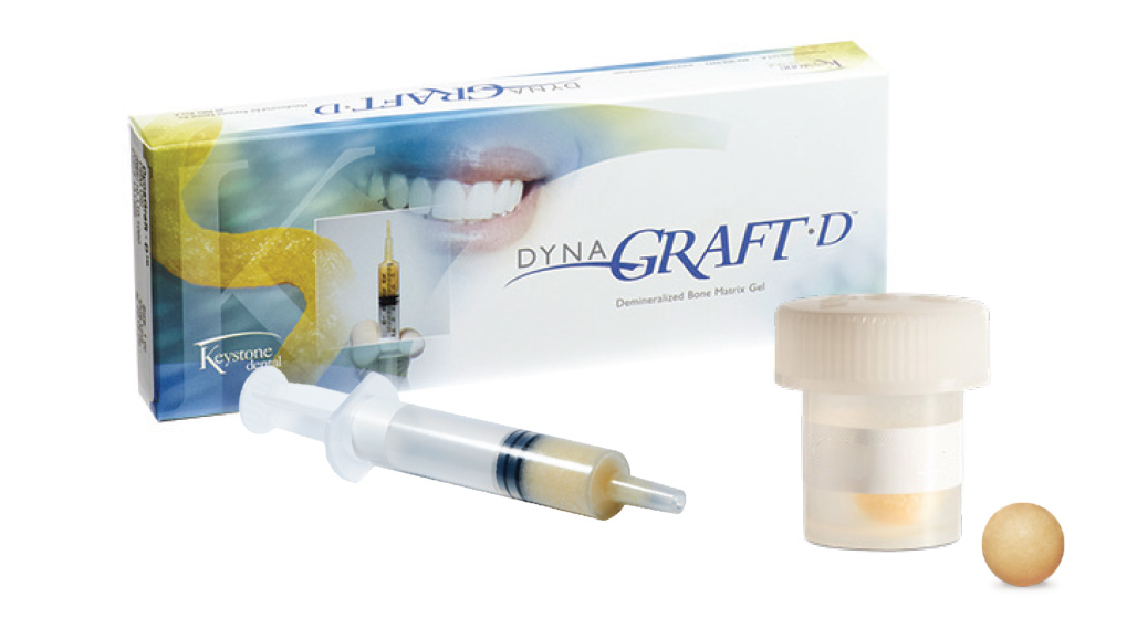 DynaGraft-D